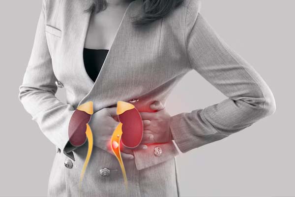 Kidney Stone